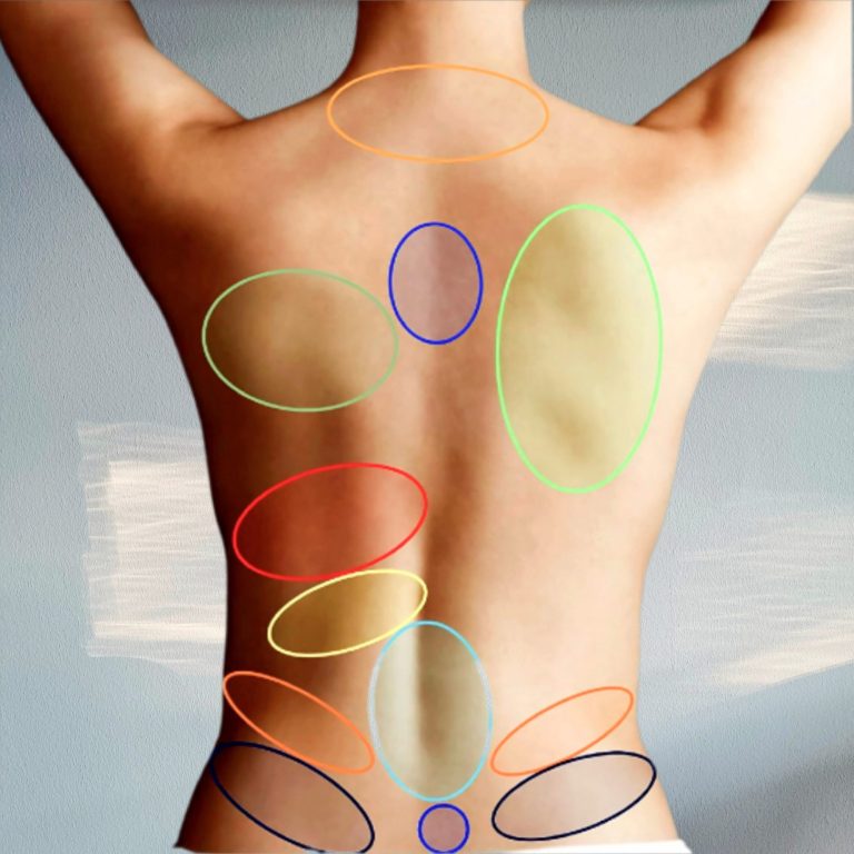 Bindegewebs-Massage BGM Hausbesuch Imme Jenner Physiotherapie